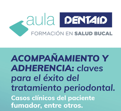 Acompañamiento y adherencia: claves para el éxito del tratamiento periodontal | Bilbao